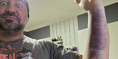 Schock-Fotos! Bambikiller bricht sein Schweigen