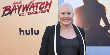 Baywatch-Star hat sich Brust abnehmen lassen