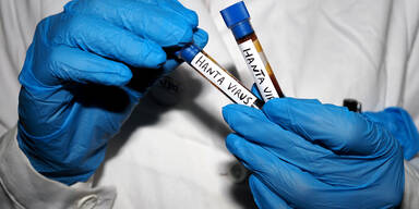 So gefährlich ist das "Hantavirus" wirklich