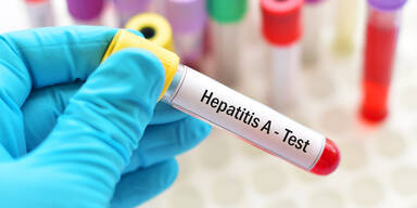 Zahl der Hepatitis A-Fälle explodiert