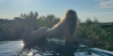 Nicht Heidi Klum! Welcher Star räkelt sich hier oben ohne am Pool?