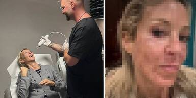 Simone Lugner schockt Fans mit neuem Instagram-Foto