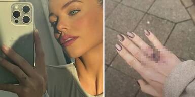 Nach Trennung: Laura Maria Rypa entfernt Lombardi-Liebes-Tattoo