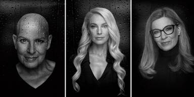 Kampf gegen Krebs: So haben Sie Kdolsky, Schneider, Kummer und Co. noch nie gesehen!