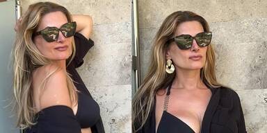 Beauty-OP für Ex-ORF-Lady Martina Kaiser? Sie gesteht: "Bin bissl g'spritzt!"