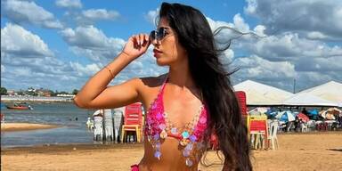Brasilianische Influencerin (26) stirbt nach Brust-Vergrößerung