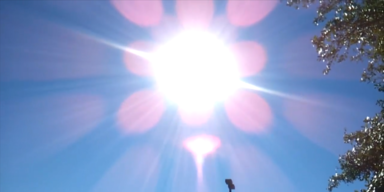 Kopie von Sonnenbrand.png