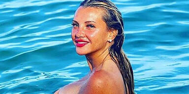 Mit 37 Jahren: Evelyn Burdecki klagt über Fettleber 