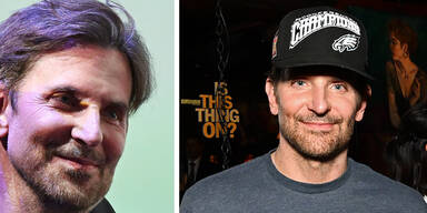 Beauty-OP-Alarm: Bradley, was hast du nur mit deinem schönen Gesicht gemacht?