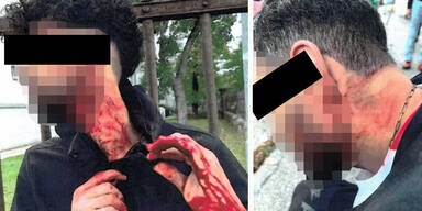 Asylwerber schlägerten sich mit zerbrochener Flasche