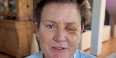 TV-Moderatorin verliert Auge bei Feuerwerk