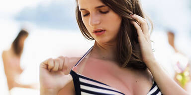 sonnenbrand.jpg